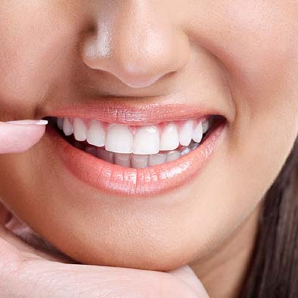 What You Need to Do to Get a Bright Smile