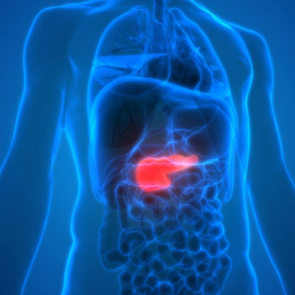 Diet Will Help You in Pancreatic Cancer.